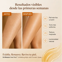 Dr. Melaxin Peel Shot | Exfoliante Corporal Iluminador con Ácido Kójico y Cúrcuma 3