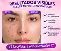 Kit Antiedad Bioaqua | Retinol + Vitamina C + Ácido Hialurónico 4