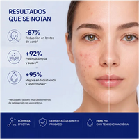 Kit Bioaqua Pure Skin | Rutina Anti-Acné en 4 Pasos 4